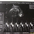 w37 d3 baby scan-heartbeat.jpg