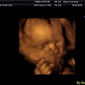 baby 4D scanning.jpg