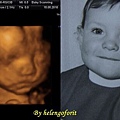 baby 4D scanning & wee mr brown.jpg