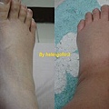 swollen feet.jpg