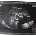 w36 d3 baby scan1.jpg