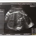 w37 d3 baby scan.jpg