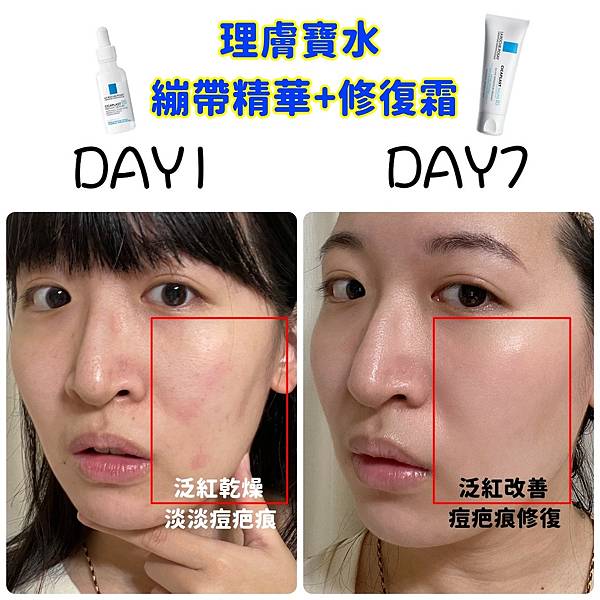 【開箱】理膚寶水B5修復家族系列產品 B5繃帶精華+B5修復