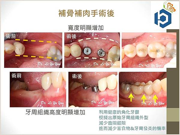 投影片9.JPG