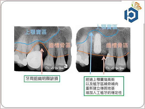 投影片5.JPG