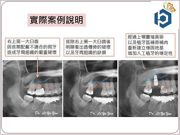 投影片4.JPG