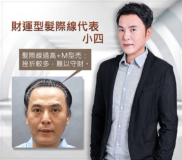 20190307_web_banner11-01.jpg 髮際線植髮提升4大運勢,顏值加分運勢滿分