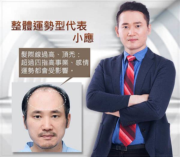 20190307_web_banner8-01.jpg 髮際線植髮提升4大運勢,顏值加分運勢滿分
