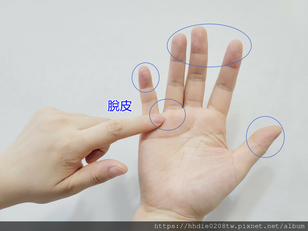使用酒精喷雾 (3).jpg