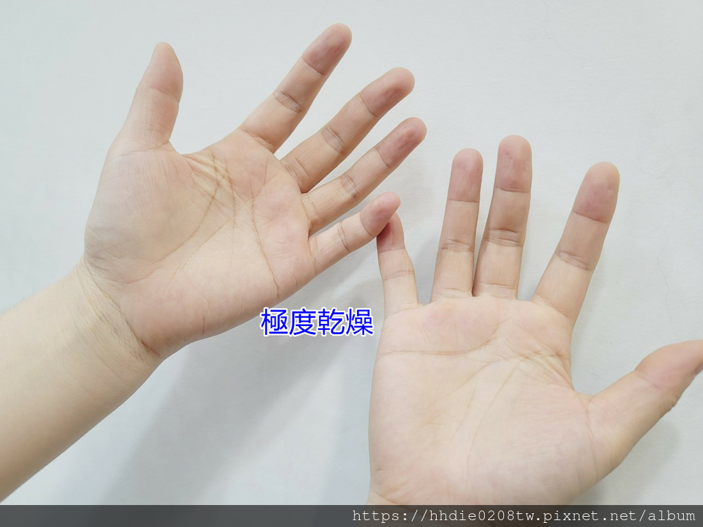 使用酒精喷雾 (2).jpg