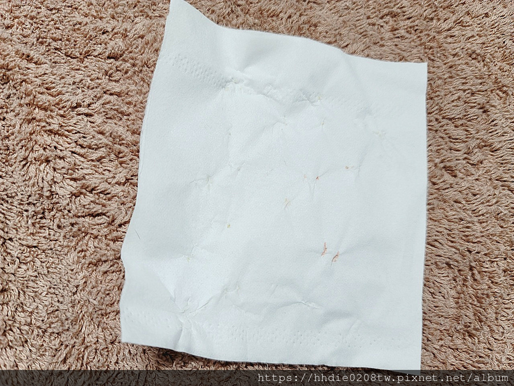 悦妍SPA液态皮秒美容 (27).jpg