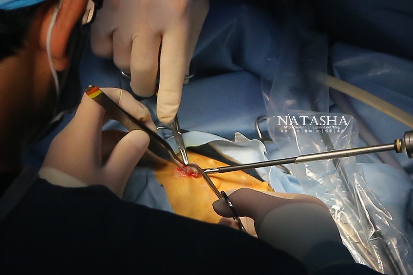 宠物结扎│腹腔镜结扎│手术过程照片影片完整公开.术前评估.