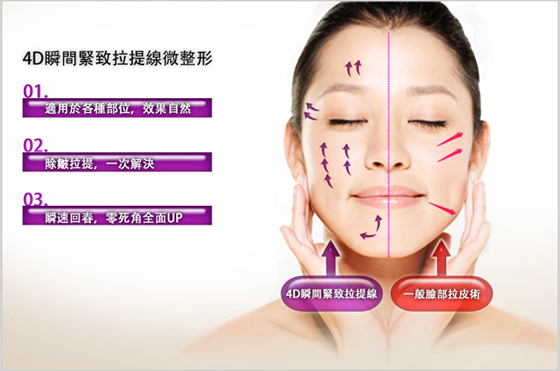4D瞬間緊致拉提線埋線發皮鬆垮下垂法令紋02