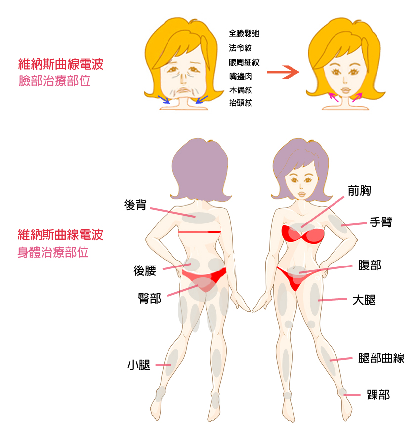 維納斯電波拉皮C