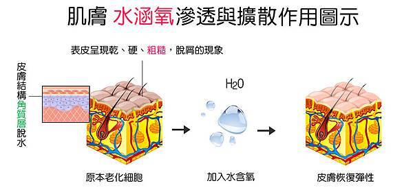 痘疤色素沉澱縮小毛孔膚色不均杏仁酸換膚高壓水涵氧換膚光纖粉餅雷射雷射光療11.jpg