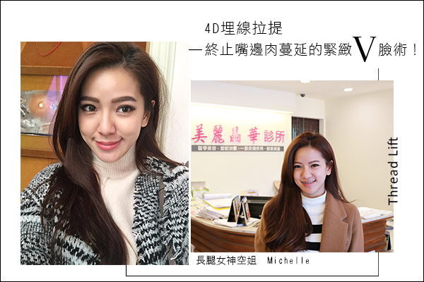 美麗晶華診所4D埋線拉皮拉提緊緻V臉微整形11.jpg 美麗晶華診所4D埋線拉皮拉提緊緻V臉微整形11.jpg