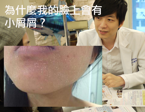 臉上屑屑 皮膚乾燥 肌膚問題 敏感型肌膚 保濕 乾燥 水涵氧 痘疤粉刺 痘痘 粉刺 臉上屑屑 皮膚乾燥 肌膚問題 敏感型肌膚 保濕 乾燥 水涵氧 痘疤粉刺 痘痘 粉刺