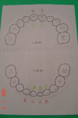 嘟嘟和琳琳的掉牙/長牙記錄(98.1.9)