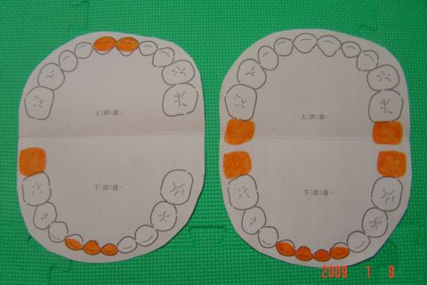 嘟嘟和琳琳的掉牙/長牙記錄(98.1.9) 嘟嘟和琳琳的掉牙/長牙記錄(98.1.9)