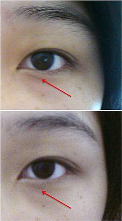 Pro-X特效修護眼霜-使用前後比較