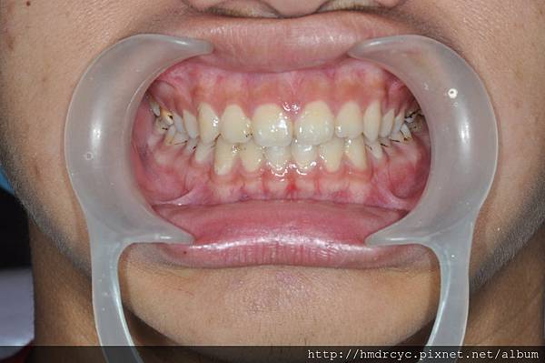 高雄牙醫/左營牙醫/牙醫推薦/高雄植牙 高雄牙醫/左營牙醫/牙醫推薦/高雄植牙