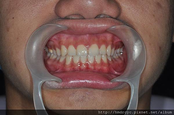 高雄牙醫/左營牙醫/牙醫推薦/高雄植牙 高雄牙醫/左營牙醫/牙醫推薦/高雄植牙