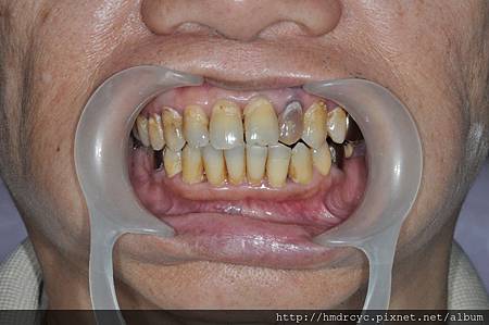 高雄牙醫/左營牙醫/牙醫推薦/高雄植牙 高雄牙醫/左營牙醫/牙醫推薦/高雄植牙