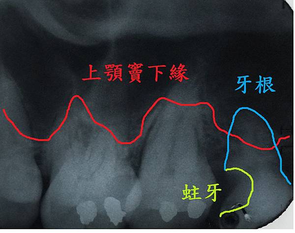 高雄牙醫/左營牙醫/牙醫推薦/高雄植牙 高雄牙醫/左營牙醫/牙醫推薦/高雄植牙