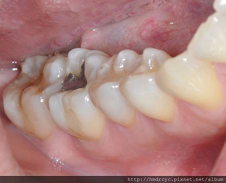 高雄牙醫/左營牙醫/牙醫推薦/高雄植牙 高雄牙醫/左營牙醫/牙醫推薦/高雄植牙