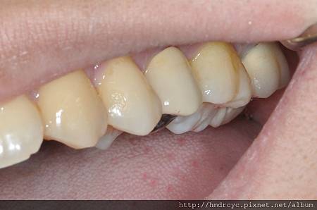 高雄牙醫/左營牙醫/牙醫推薦/高雄植牙 高雄牙醫/左營牙醫/牙醫推薦/高雄植牙