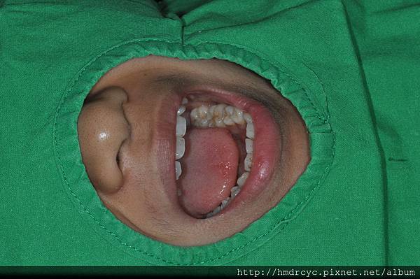 高雄牙醫/左營牙醫/牙醫推薦/高雄植牙 高雄牙醫/左營牙醫/牙醫推薦/高雄植牙