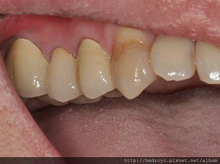 高雄牙醫/左營牙醫/牙醫推薦/高雄植牙 高雄牙醫/左營牙醫/牙醫推薦/高雄植牙