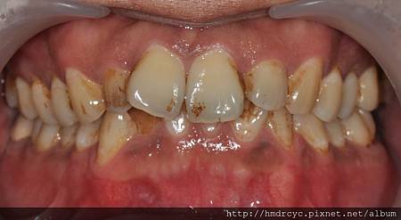 高雄牙醫/左營牙醫/牙醫推薦/高雄植牙 高雄牙醫/左營牙醫/牙醫推薦/高雄植牙