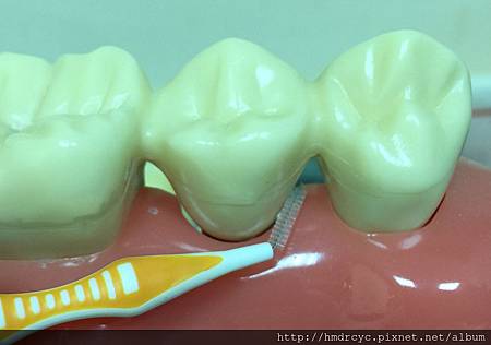 高雄牙醫/左營牙醫/牙醫推薦/高雄植牙 高雄牙醫/左營牙醫/牙醫推薦/高雄植牙