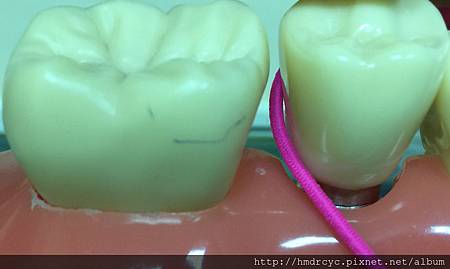 高雄牙醫/左營牙醫/牙醫推薦/高雄植牙 高雄牙醫/左營牙醫/牙醫推薦/高雄植牙