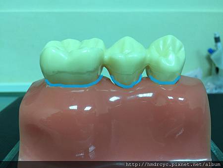 高雄牙醫/左營牙醫/牙醫推薦/高雄植牙 高雄牙醫/左營牙醫/牙醫推薦/高雄植牙