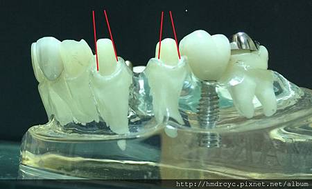 高雄牙醫/左營牙醫/牙醫推薦/高雄植牙 高雄牙醫/左營牙醫/牙醫推薦/高雄植牙