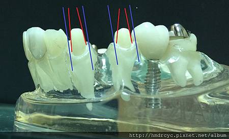 高雄牙醫/左營牙醫/牙醫推薦/高雄植牙 高雄牙醫/左營牙醫/牙醫推薦/高雄植牙