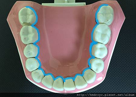 高雄牙醫/左營牙醫/牙醫推薦/高雄植牙 高雄牙醫/左營牙醫/牙醫推薦/高雄植牙