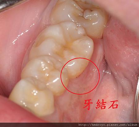 高雄牙醫/左營牙醫/牙醫推薦/高雄植牙 高雄牙醫/左營牙醫/牙醫推薦/高雄植牙