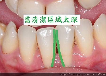高雄牙醫/左營牙醫/牙醫推薦/高雄植牙 高雄牙醫/左營牙醫/牙醫推薦/高雄植牙