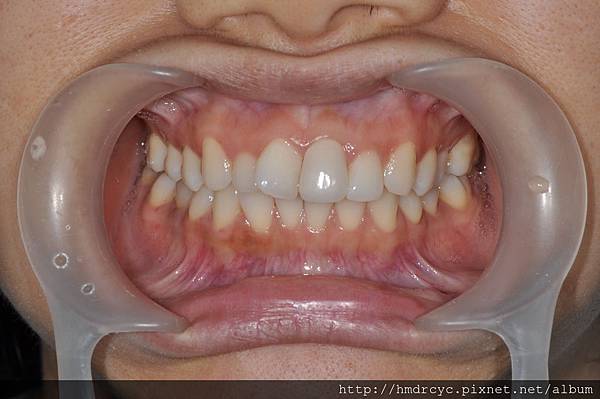 高雄牙醫/左營牙醫/牙醫推薦/高雄植牙 高雄牙醫/左營牙醫/牙醫推薦/高雄植牙