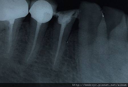 高雄牙醫/左營牙醫/牙醫推薦/高雄植牙 高雄牙醫/左營牙醫/牙醫推薦/高雄植牙