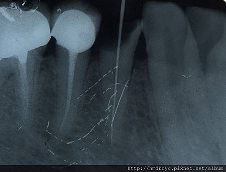 高雄牙醫/左營牙醫/牙醫推薦/高雄植牙 高雄牙醫/左營牙醫/牙醫推薦/高雄植牙