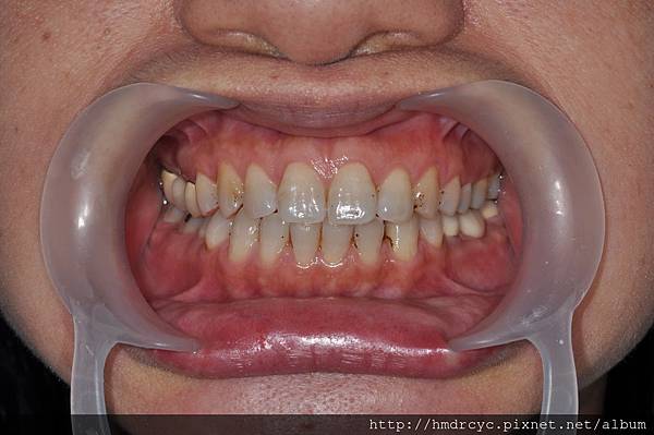 高雄牙醫/左營牙醫/牙醫推薦/高雄植牙 高雄牙醫/左營牙醫/牙醫推薦/高雄植牙