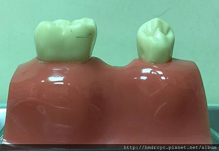 高雄牙醫/左營牙醫/牙醫推薦/高雄植牙 高雄牙醫/左營牙醫/牙醫推薦/高雄植牙