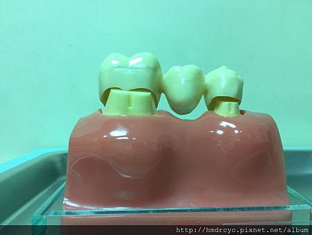 高雄牙醫/左營牙醫/牙醫推薦/高雄植牙 高雄牙醫/左營牙醫/牙醫推薦/高雄植牙