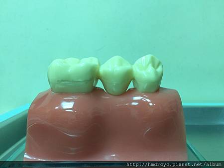 高雄牙醫/左營牙醫/牙醫推薦/高雄植牙 高雄牙醫/左營牙醫/牙醫推薦/高雄植牙