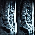 mri-herniated-disc-illinois-back-pain.jpg