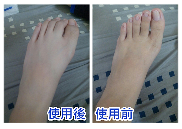 使用前後.png 試用